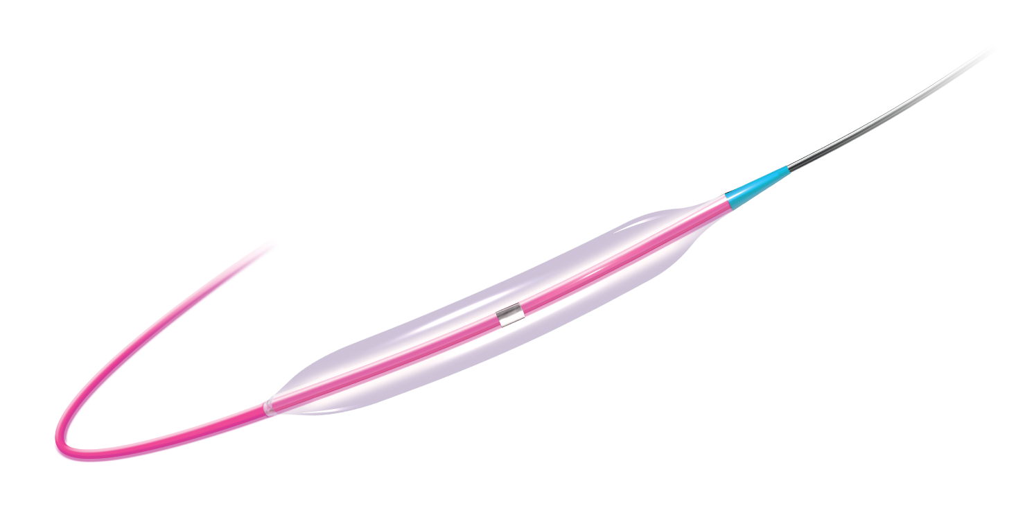 Sapphire II PRO 1.0mm Balloon