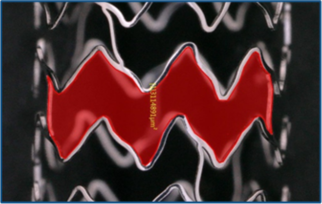 Stent side branch access macro photo